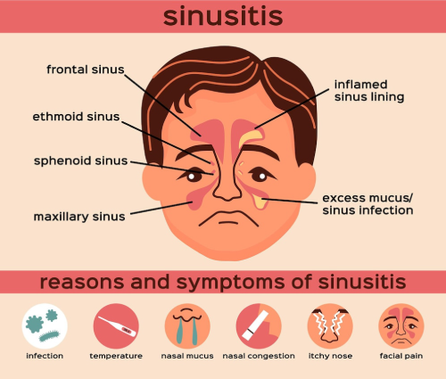 nasal disease flat infographics layout with reason